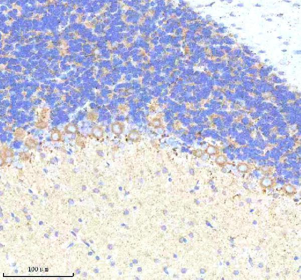 m01439 c1qbp primary antibodies ihc testing 7