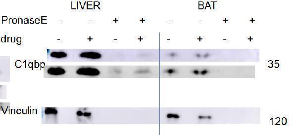  Western blot analysis of C1QBP using anti-C1QBP antibody (M01439)