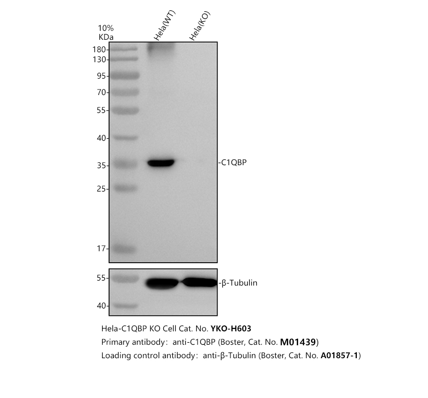 Western blot analysis of C1QBP using anti-C1QBP antibody (M01439)