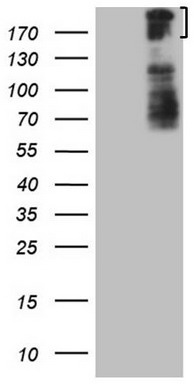 HEK293T cells were transfected with the pCMV6-ENTRY control (Left lane) or pCMV6-ENTRY BCOR (Right lane) cDNA for 48 hrs and lysed
