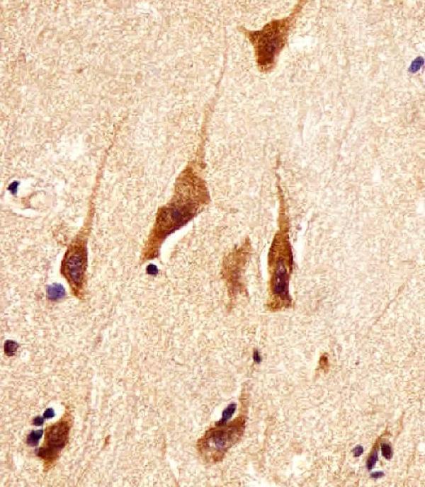 M01443-1 staining ARRB2 in human brain tissue sections by Immunohistochemistry (IHC-P -paraformaldehyde-fixed, paraffin-embedded sections)