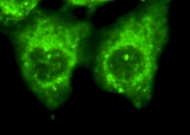 Immunofluorescence analysis of HeLa cells using Arrestin-β-2 Monoclonal Antibody
