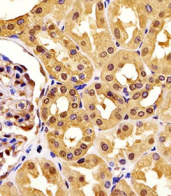 m01449 1 anti pgk1 antibody ihc p testing 2