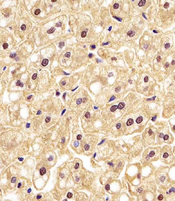 m01449 1 anti pgk1 antibody ihc p testing 3