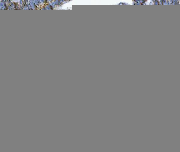  IHC analysis of Annexin A1/ANXA1 using anti-Annexin A1/ANXA1 antibody (M01451-3)