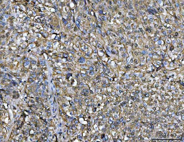  IHC analysis of Annexin A1/ANXA1 using anti-Annexin A1/ANXA1 antibody (M01451-3)