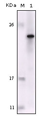 Western Blot analysis using Fes Monoclonal Antibody against truncated Fes recombinant protein