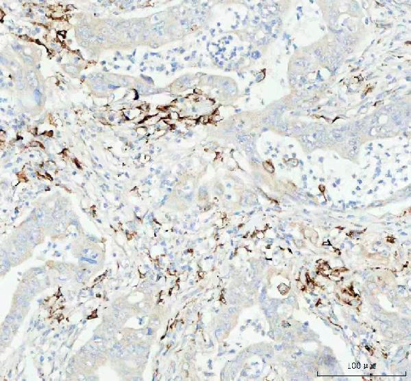  IHC analysis of Cathepsin B using anti-Cathepsin B antibody (M01456)