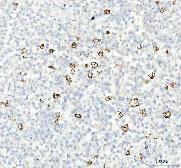  IHC analysis of Cathepsin B using anti-Cathepsin B antibody (M01456)