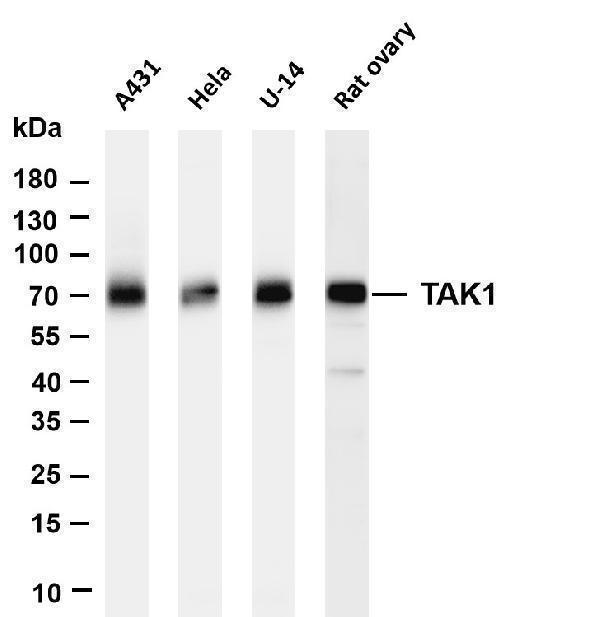 Various whole cell lysates were separated by 4-20% SDS-PAGE, and the membrane was blotted with anti-TAK1 antibody