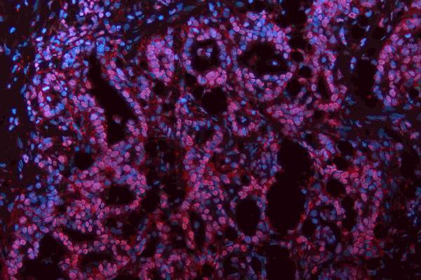 m01459 hes1 primary antibodies if testing 10