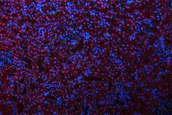 m01459 hes1 primary antibodies if testing 11