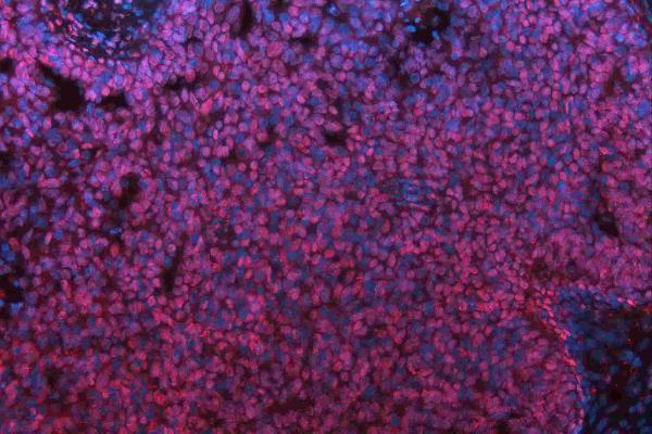 m01459 hes1 primary antibodies if testing 7