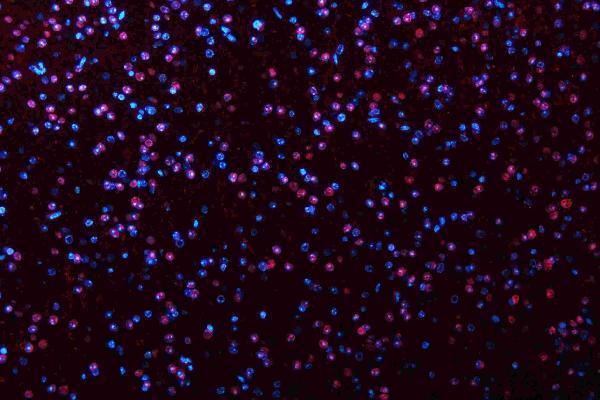 m01459 hes1 primary antibodies if testing 8