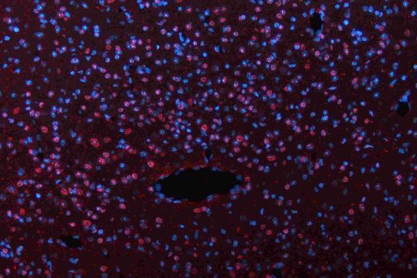 m01459 hes1 primary antibodies if testing 9