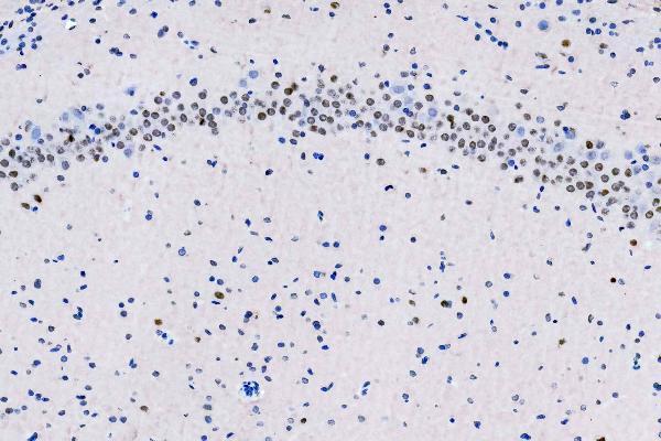m01459 hes1 primary antibodies ihc testing 3