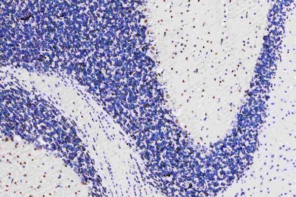 m01459 hes1 primary antibodies ihc testing 4
