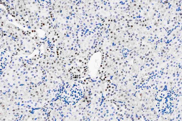 m01459 hes1 primary antibodies ihc testing 5