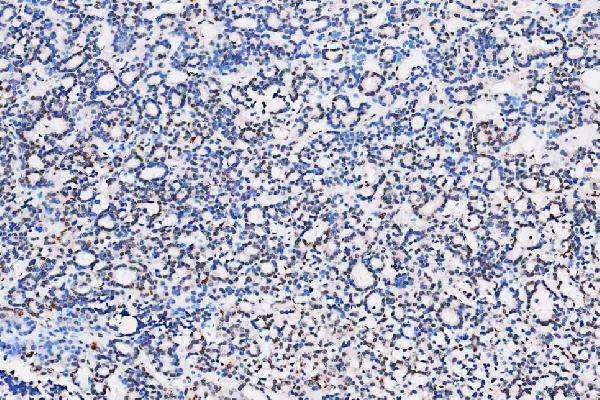 m01459 hes1 primary antibodies ihc testing 6