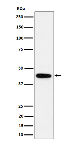 Western blot analysis of GALT expression in K562 cell lysate