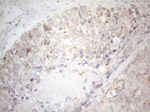 m01461 anti btg2 mouse monoclonal antibody clone id oti4c10 ihc testing 2