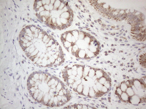 m01461 anti btg2 mouse monoclonal antibody clone id oti4c10 ihc testing 3