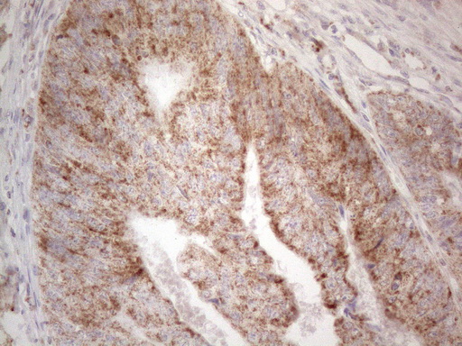 m01461 anti btg2 mouse monoclonal antibody clone id oti4c10 ihc testing 4