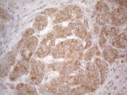 m01461 anti btg2 mouse monoclonal antibody clone id oti4c10 ihc testing 6