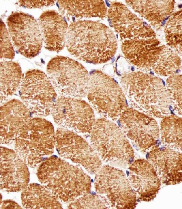 m01463 1 anti rptor antibody ihc p testing 2