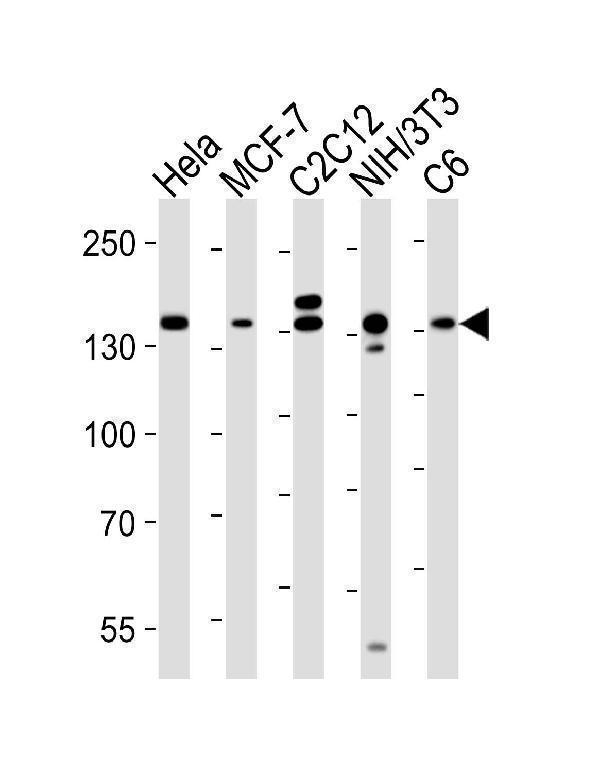m01463 1 anti rptor antibody wb testing 1