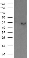 HEK293T cells were transfected with the pCMV6-ENTRY control (Left lane) or pCMV6-ENTRY PDIA3 (Right lane) cDNA for 48 hrs and lysed
