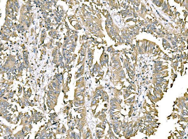  IHC analysis of ERp57 using anti-ERp57 antibody (M01464-4)