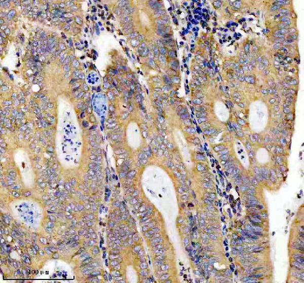 m01464 pdia3 primary antibodies ihc testing 1