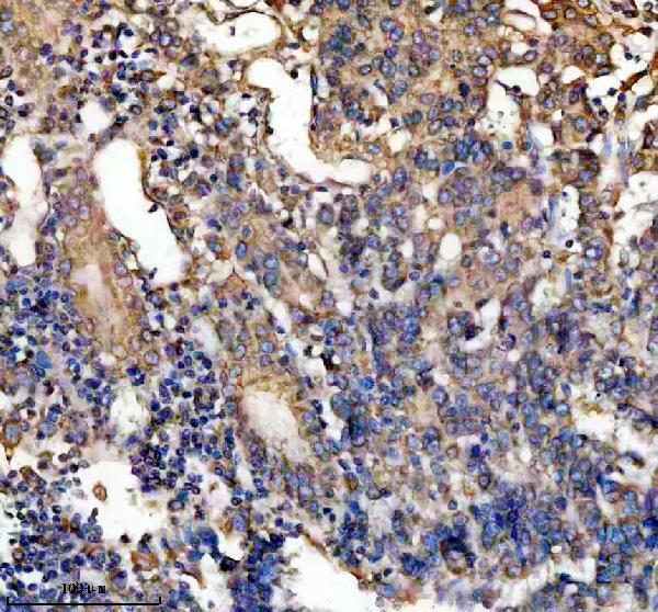 m01464 pdia3 primary antibodies ihc testing 2