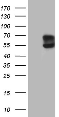 m01468 anti acvrl1 mouse monoclonal antibody clone id oti5c2 wb testing 1