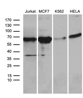 m01468 anti acvrl1 mouse monoclonal antibody clone id oti5c2 wb testing 2