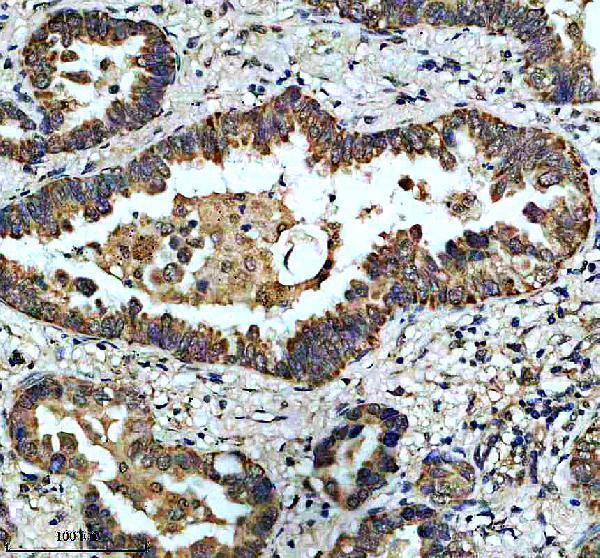 IHC analysis of BNIP3 using anti-BNIP3 antibody (M01469-2)