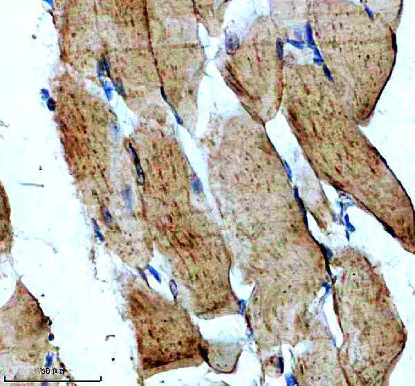 IHC analysis of BNIP3 using anti-BNIP3 antibody (M01469-2)