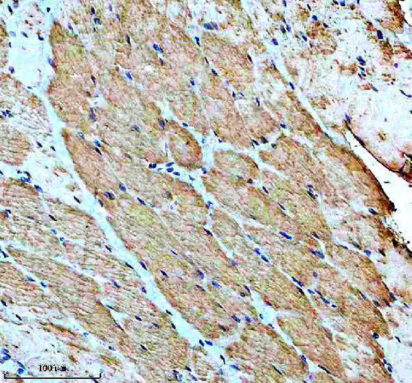 IHC analysis of BNIP3 using anti-BNIP3 antibody (M01469-2)