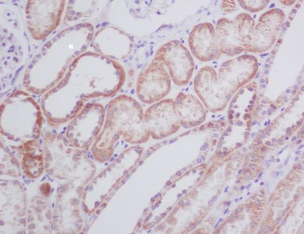 m01469 ihc