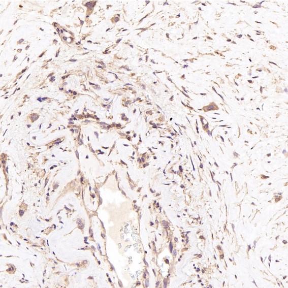 m01469 ihc8