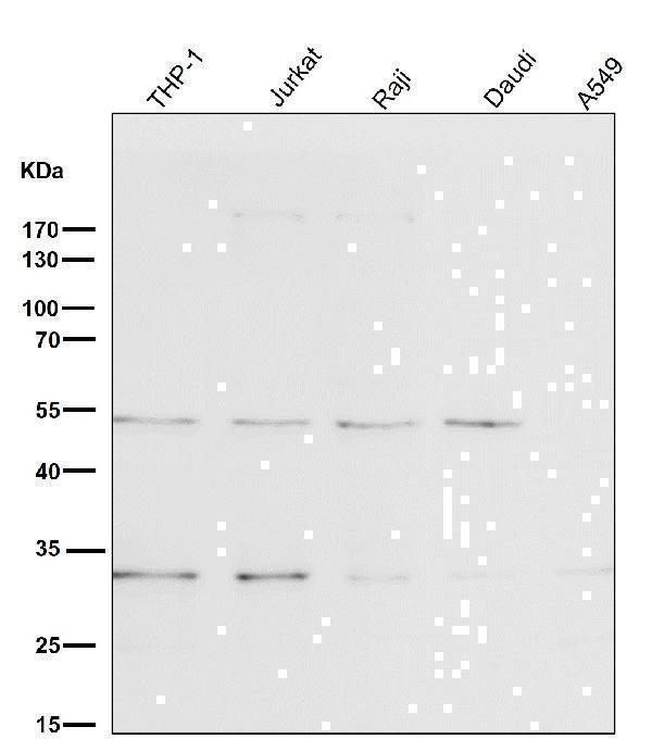 All lanes use the Antibody at 1:1K dilution for 1 hour at room temperature