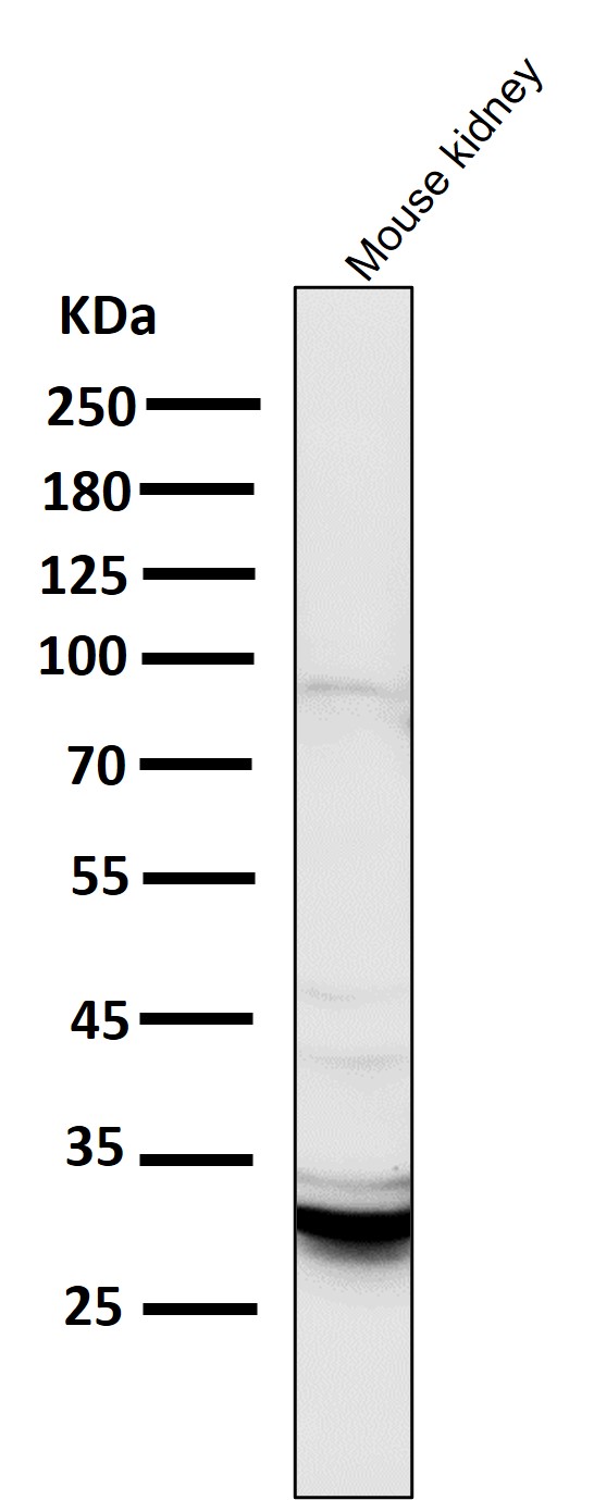 All lanes use the Antibody at 1:2K dilution for 1 hour at room temperature