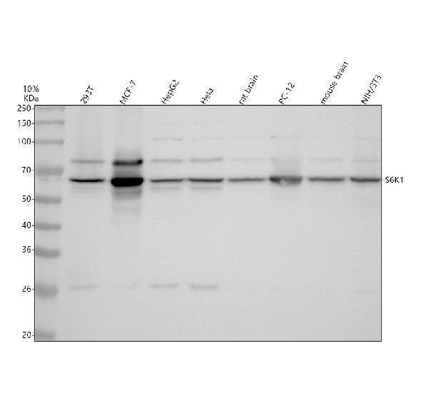 m01475 1 rps6kb1 primary antibodies wb testing 1