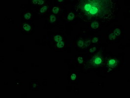 m01475 2 anti s6k1 rps6kb1 mouse monoclonal antibody clone id oti4g4 if testing 4