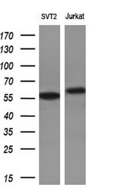 m01475 2 anti s6k1 rps6kb1 mouse monoclonal antibody clone id oti4g4 wb testing 2