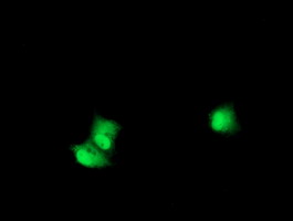 m01475 3 anti s6k1 rps6kb1 mouse monoclonal antibody clone id oti6b2 if testing 5