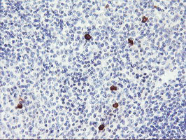 m01475 3 anti s6k1 rps6kb1 mouse monoclonal antibody clone id oti6b2 ihc testing 4
