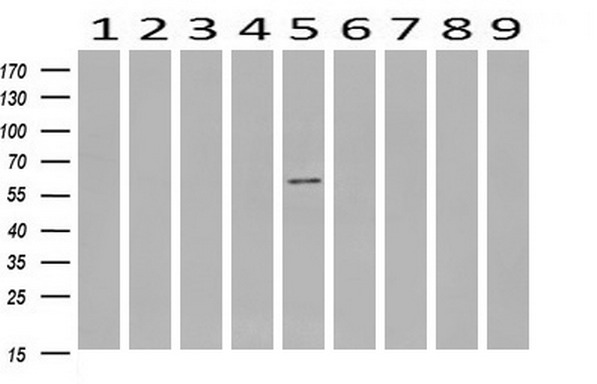 m01475 3 anti s6k1 rps6kb1 mouse monoclonal antibody clone id oti6b2 wb testing 2