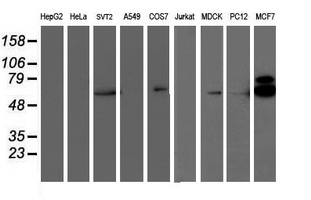 m01475 3 anti s6k1 rps6kb1 mouse monoclonal antibody clone id oti6b2 wb testing 3
